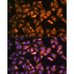 Sterol O-Acyltransferase 1 (SOAT1) Antibody