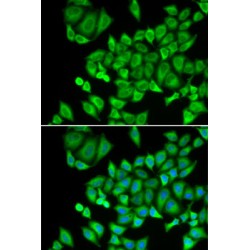 Dehydrogenase/Reductase SDR Family Member 9 (DHRS9) Antibody