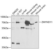 Western blot analysis of various lysates using ZMYND11 Antibody at 1/1000 dilution. Secondary antibody: HRP-conjugated Goat anti-Rabbit IgG (H+L) at 1/10000 dilution. Lysates/proteins: 25 µg per lane. Blocking buffer: 3% nonfat dry milk in TBST. Exposure time: 90s.