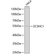 Western blot analysis of lysates from HeLa cells, using ZC3HC1 Antibody at 1/1000 dilution. Secondary antibody: HRP-conjugated Goat anti-Rabbit IgG (H+L) at 1/10000 dilution. Lysates/proteins: 25 µg per lane. Blocking buffer: 3% nonfat dry milk in TBST. Exposure time: 90s.
