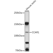 Western blot analysis of lysates from Mouse testis, using CCAR1 Antibody at 1/1000 dilution. Secondary antibody: HRP-conjugated Goat anti-Rabbit IgG (H+L) at 1/10000 dilution. Lysates/proteins: 25 µg per lane. Blocking buffer: 3% nonfat dry milk in TBST. Exposure time: 5s.