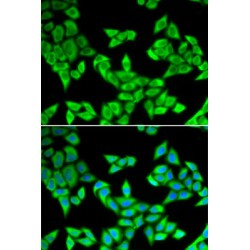Anamorsin (CIAPIN1) Antibody