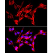 Western blot analysis of various lysates using Fibroblast activation protein-α (FAP) Antibodyat 1/1000 dilution incubated overnight at 4 °C. Secondary antibody: HRP-conjugated Goat anti-Rabbit IgG (H+L) at 1/10000 dilution. Lysates/proteins: 25 µg per lane. Blocking buffer: 3% nonfat dry milk in TBST. Negative control (NC): SK-MEL-28 Exposure time: 30s.