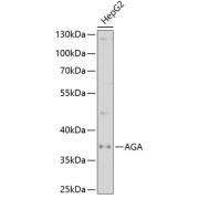 Western blot analysis of lysates from HepG2 cells, using AGA Antibody at 1/1000 dilution. Secondary antibody: HRP-conjugated Goat anti-Rabbit IgG (H+L) at 1/10000 dilution. Lysates/proteins: 25 µg per lane. Blocking buffer: 3% nonfat dry milk in TBST. Exposure time: 30s.