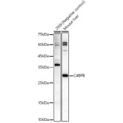 Western blot analysis of various lysates, using C4BPB Antibody at 1/900 dilution. Secondary antibody: HRP-conjugated Goat anti-Rabbit IgG (H+L) at 1/10000 dilution. Lysates/proteins: 25 µg per lane. Blocking buffer: 3% nonfat dry milk in TBST. Exposure time: 10s.