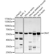 Western blot analysis of various lysates using CRAT Antibody at 1/500 dilution. Secondary antibody: HRP-conjugated Goat anti-Rabbit IgG (H+L) at 1/10000 dilution. Lysates/proteins: 25 µg per lane. Blocking buffer: 3% nonfat dry milk in TBST. Exposure time: 90s.