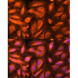 Thymidylate Kinase (DTYMK) Antibody