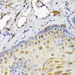 Fatty Acid Binding Protein 5, Epidermal (FABP5) Antibody