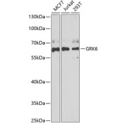 Western blot analysis of various lysates using GRK6 Antibody at 1/1000 dilution. Secondary antibody: HRP-conjugated Goat anti-Rabbit IgG (H+L) at 1/10000 dilution. Lysates/proteins: 25 µg per lane. Blocking buffer: 3% nonfat dry milk in TBST. Exposure time: 90s.