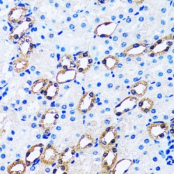 Inositol Monophosphatase 1 (IMPA1) Antibody
