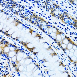 Inositol Monophosphatase 1 (IMPA1) Antibody