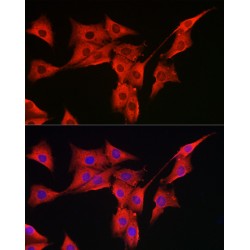 Mitochondrial Peptide Methionine Sulfoxide Reductase (MSRA) Antibody