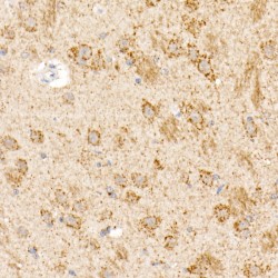 Oxoglutarate Dehydrogenase (OGDH) Antibody