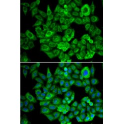 Oxoglutarate Dehydrogenase (OGDH) Antibody