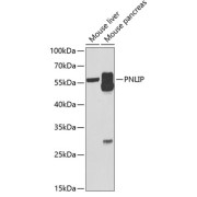 Western blot analysis of various lysates using PNLIP Antibody at 1/1000 dilution. Secondary antibody: HRP-conjugated Goat anti-Rabbit IgG (H+L) at 1/10000 dilution. Lysates/proteins: 25 µg per lane. Blocking buffer: 3% nonfat dry milk in TBST. Exposure time: 5s.