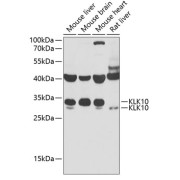Western blot analysis of various lysates using KLK10 Antibody at 1/1000 dilution. Secondary antibody: HRP-conjugated Goat anti-Rabbit IgG (H+L) at 1/10000 dilution. Lysates/proteins: 25 µg per lane. Blocking buffer: 3% nonfat dry milk in TBST. Exposure time: 90s.