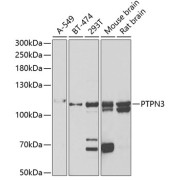 Western blot analysis of various lysates using PTPN3 Antibody at 1/1000 dilution. Secondary antibody: HRP-conjugated Goat anti-Rabbit IgG (H+L) at 1/10000 dilution. Lysates/proteins: 25 µg per lane. Blocking buffer: 3% nonfat dry milk in TBST. Exposure time: 10s.