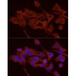 Glycogen Phosphorylase, Brain (PYGB) Antibody