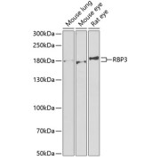 Western blot analysis of various lysates using RBP3 Antibody at 1/1000 dilution. Secondary antibody: HRP-conjugated Goat anti-Rabbit IgG (H+L) at 1/10000 dilution. Lysates/proteins: 25 µg per lane. Blocking buffer: 3% nonfat dry milk in TBST. Exposure time: 90s.