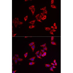Ribosomal Protein L9 (RPL9) Antibody
