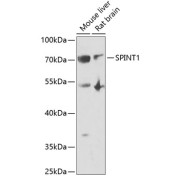 Western blot analysis of various lysates using SPINT1 Antibody at 1/1000 dilution. Secondary antibody: HRP-conjugated Goat anti-Rabbit IgG (H+L) at 1/10000 dilution. Lysates/proteins: 25 µg per lane. Blocking buffer: 3% nonfat dry milk in TBST. Exposure time: 90s.