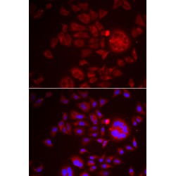 Serine Peptidase Inhibitor, Kunitz Type 1 (SPINT1) Antibody