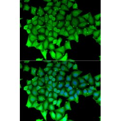 mRNA-Capping Enzyme (RNGTT) Antibody