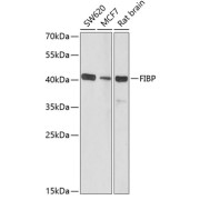 Western blot analysis of various lysates using FIBP Antibody at 1/1000 dilution. Secondary antibody: HRP-conjugated Goat anti-Rabbit IgG (H+L) at 1/10000 dilution. Lysates/proteins: 25 µg per lane. Blocking buffer: 3% nonfat dry milk in TBST. Exposure time: 90s.