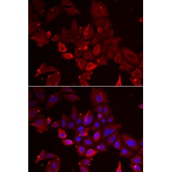Myotilin (MYOT) Antibody