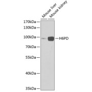 Western blot analysis of various lysates using H6PD Antibody at 1/1000 dilution. Secondary antibody: HRP-conjugated Goat anti-Rabbit IgG (H+L) at 1/10000 dilution. Lysates/proteins: 25 µg per lane. Blocking buffer: 3% nonfat dry milk in TBST. Exposure time: 90s.