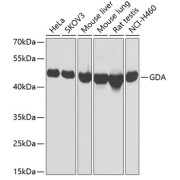 Western blot analysis of various lysates using GDA Antibody at 1/1000 dilution. Secondary antibody: HRP-conjugated Goat anti-Rabbit IgG (H+L) at 1/10000 dilution. Lysates/proteins: 25 µg per lane. Blocking buffer: 3% nonfat dry milk in TBST. Exposure time: 30s.