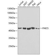 Western blot analysis of various lysates using PAICS Antibody at 1/1000 dilution. Secondary antibody: HRP-conjugated Goat anti-Rabbit IgG (H+L) at 1/10000 dilution. Lysates/proteins: 25 µg per lane. Blocking buffer: 3% nonfat dry milk in TBST. Exposure time: 30s.