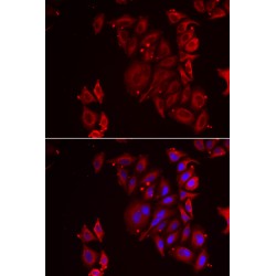 Multifunctional Protein ADE2H1 (PAICS) Antibody