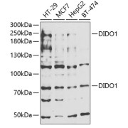 Western blot analysis of various lysates using DIDO1 Antibody at 1/1000 dilution. Secondary antibody: HRP-conjugated Goat anti-Rabbit IgG (H+L) at 1/10000 dilution. Lysates/proteins: 25 µg per lane. Blocking buffer: 3% nonfat dry milk in TBST. Exposure time: 30s.