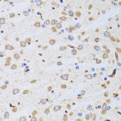 Peptidyl-tRNA Hydrolase 2 (PTRH2) Antibody