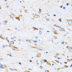 Peptidyl-tRNA Hydrolase 2 (PTRH2) Antibody