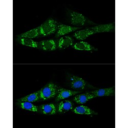 Acetyl-Coenzyme A Synthetase, Cytoplasmic (ACSS2) Antibody