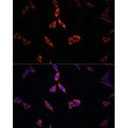 Acetyl-Coenzyme A Synthetase, Cytoplasmic (ACSS2) Antibody