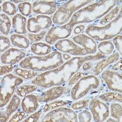DNA Damage Inducible Transcript 3 (DDIT3) Antibody