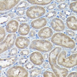 DNA Damage Inducible Transcript 3 (DDIT3) Antibody