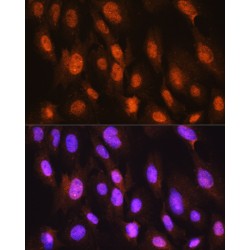 DNA Damage Inducible Transcript 3 (DDIT3) Antibody