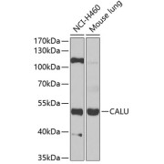 Western blot analysis of various lysates using CALU Antibody at 1/1000 dilution. Secondary antibody: HRP-conjugated Goat anti-Rabbit IgG (H+L) at 1/10000 dilution. Lysates/proteins: 25 µg per lane. Blocking buffer: 3% nonfat dry milk in TBST. Detection: ECL Basic Kit (RM00020). Exposure time: 90s.