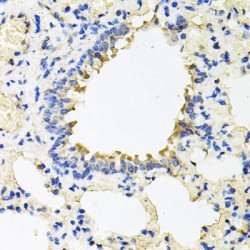 Calumenin (CALU) Antibody