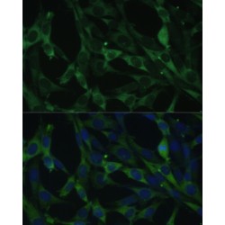Calumenin (CALU) Antibody