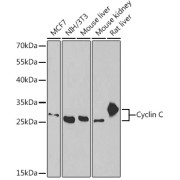 Western blot analysis of various lysates using Cyclin C Antibody at 1/1000 dilution. Secondary antibody: HRP-conjugated Goat anti-Rabbit IgG (H+L) at 1/10000 dilution. Lysates/proteins: 25 µg per lane. Blocking buffer: 3% nonfat dry milk in TBST. Exposure time: 60s.