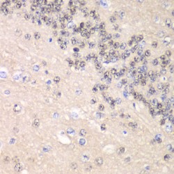 Cyclin-C (CCNC) Antibody