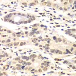 Cyclin-C (CCNC) Antibody