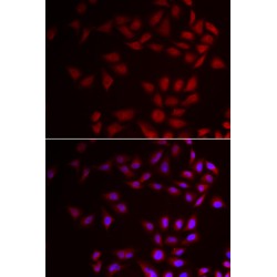 Cold-Inducible RNA-Binding Protein (CIRBP) Antibody