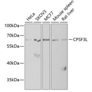 Western blot analysis of various lysates using CPSF3L Antibody at 1/1000 dilution. Secondary antibody: HRP-conjugated Goat anti-Rabbit IgG (H+L) at 1/10000 dilution. Lysates/proteins: 25 µg per lane. Blocking buffer: 3% nonfat dry milk in TBST. Exposure time: 90s.