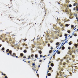 Probable ATP-Dependent RNA Helicase DDX41 (DDX41) Antibody